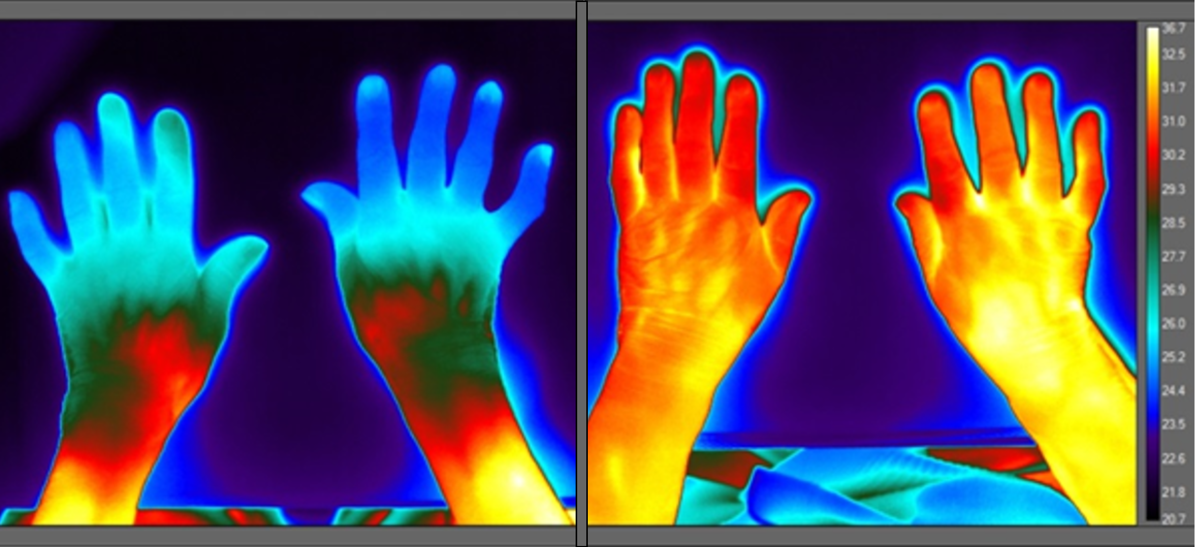 Two pairs of hands under thermal imaging camera